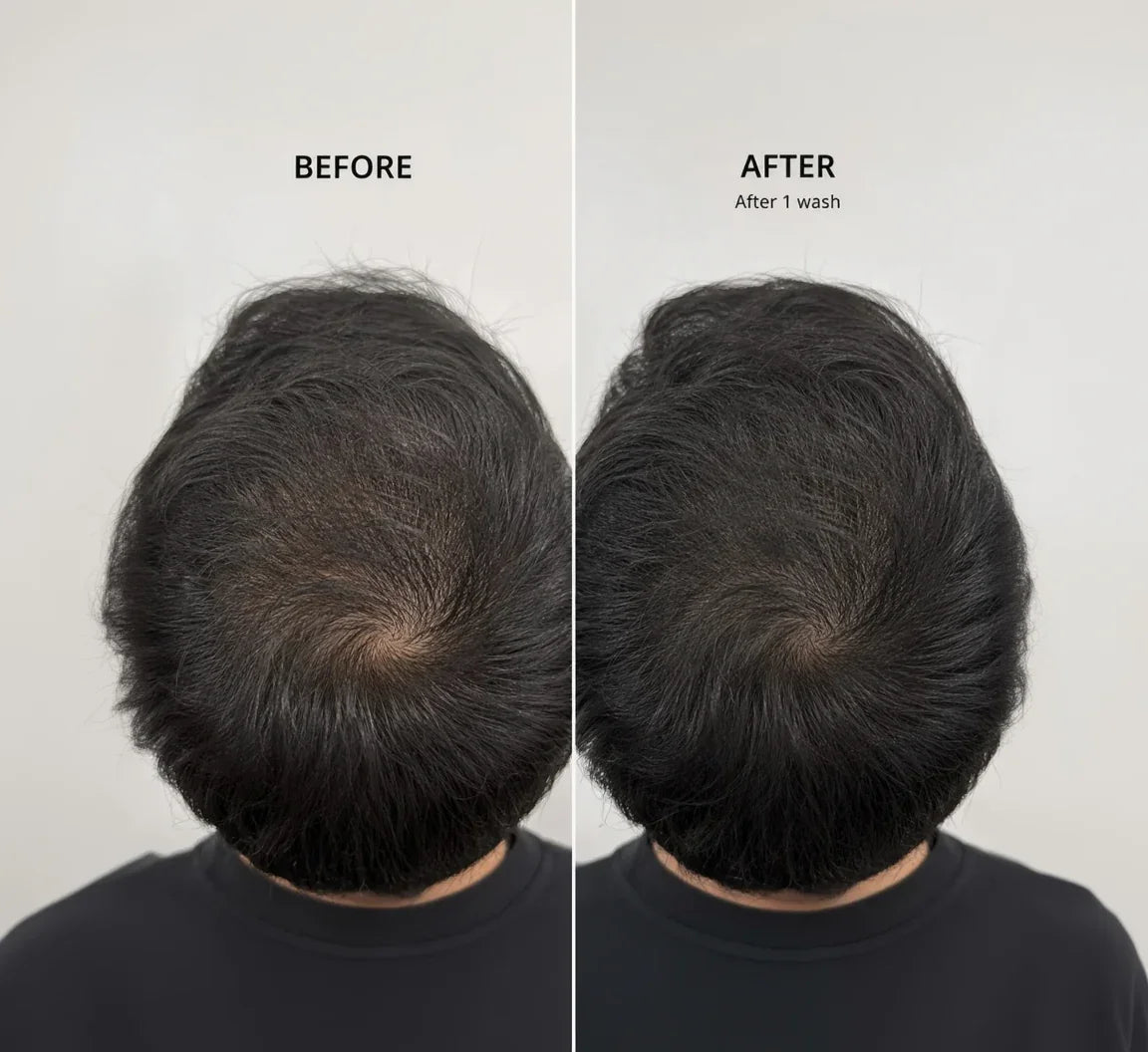 Before and after hair volume boost after one wash, showing reduced thinning and fuller scalp
